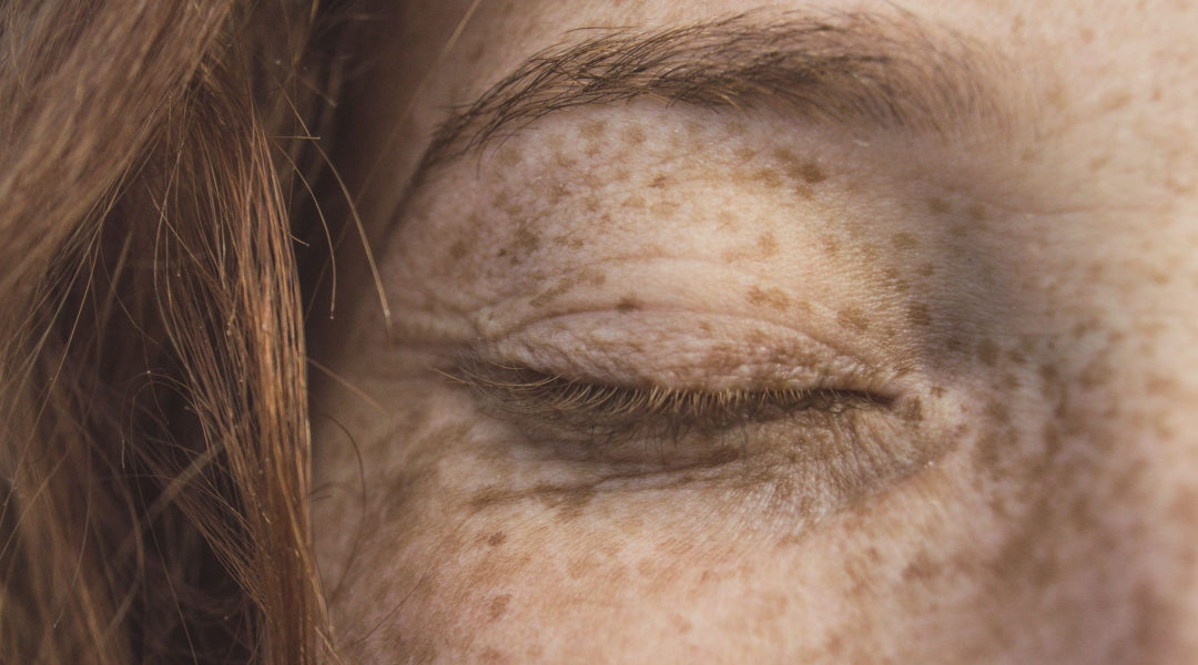 What Researchers Are Doing About Skin Cancer and How to Prevent It